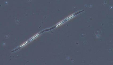 Phytoplancton Photographie d'une cellule de phytoplancton